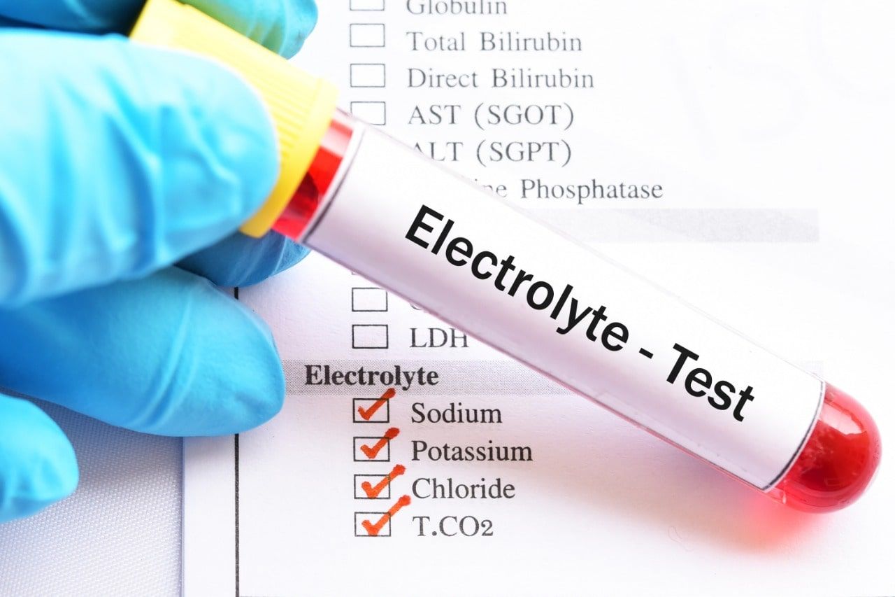 electrolyte metabolic treatment in hyderabad