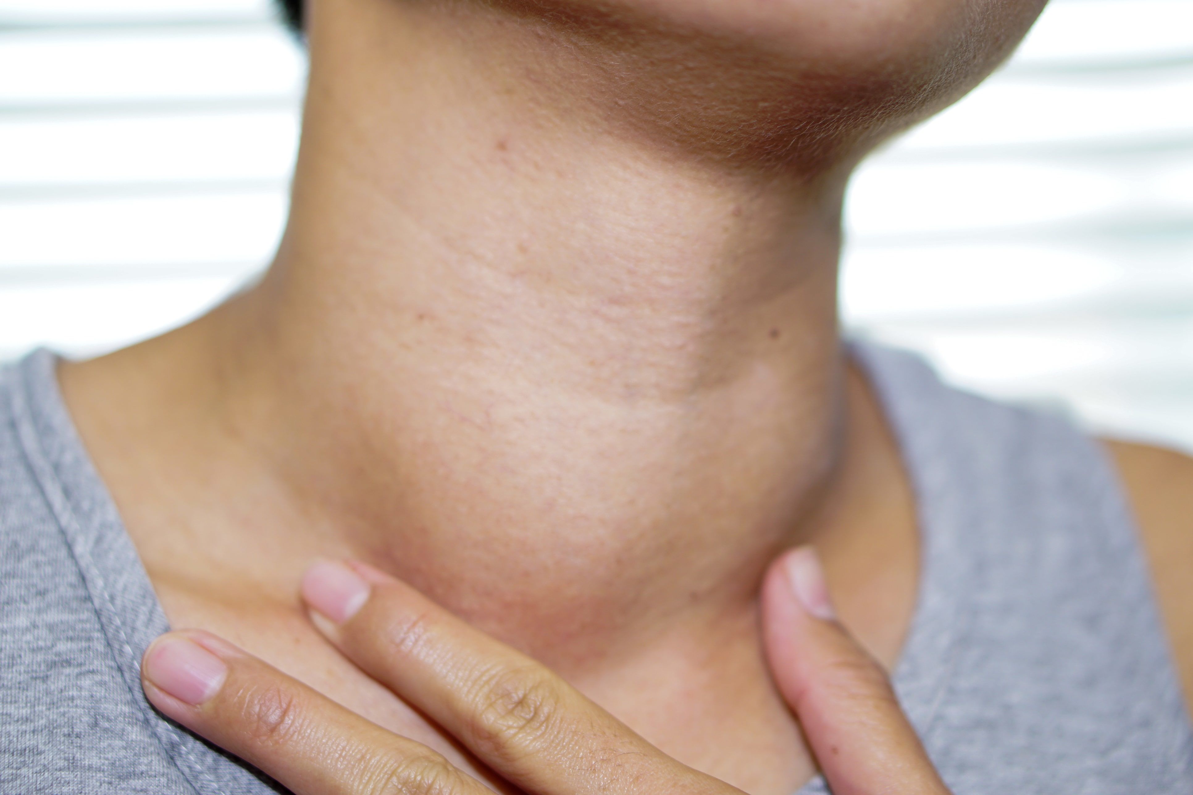 thyroid nodules symptoms
